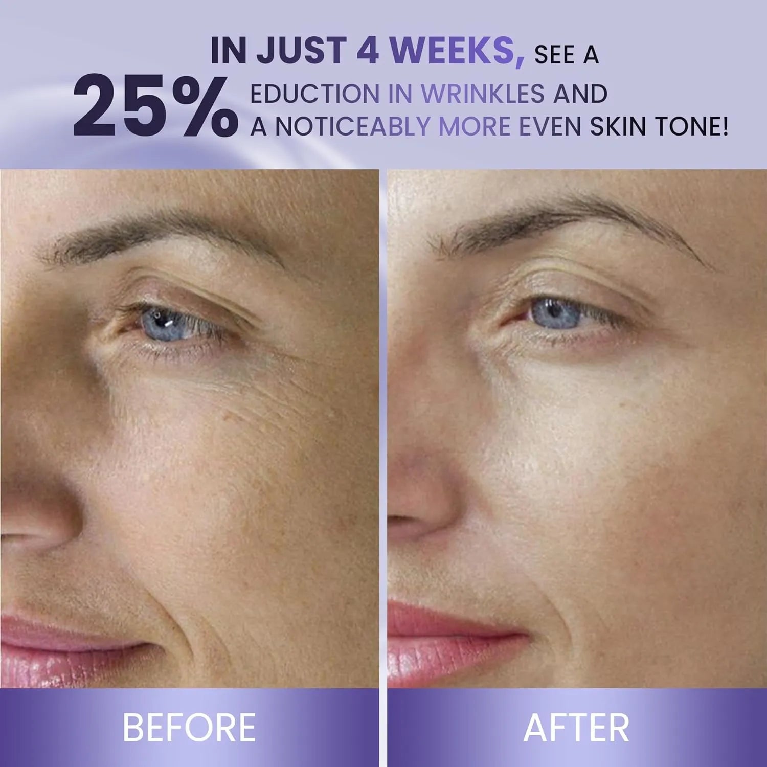 Belani Retinol Face Cream - Advanced Anti-Aging Night Moisturizer