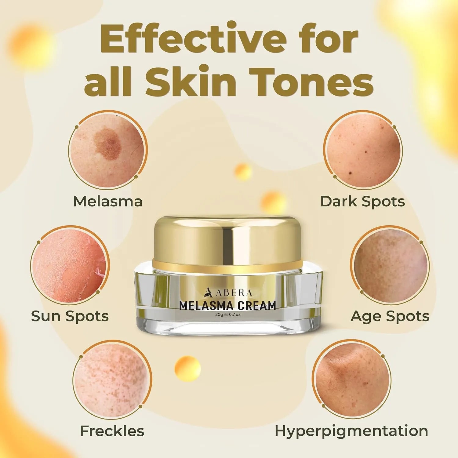 Niacinamide Melasma Cream Dark Spot Corrector