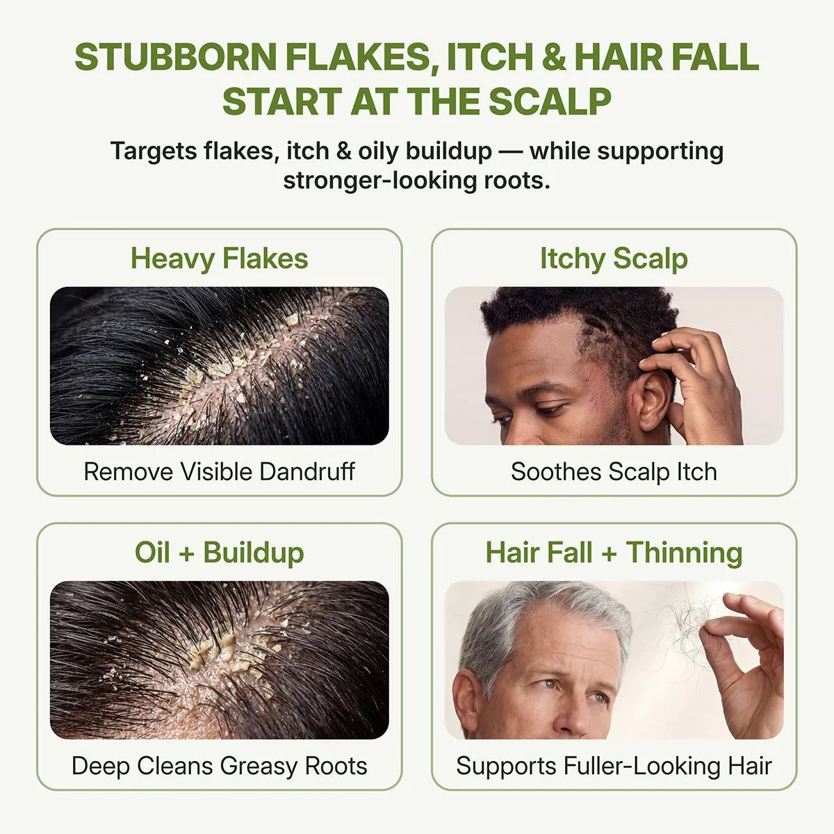 ABERA Ginseng Anti-Dandruff & Hair Loss Shampoo