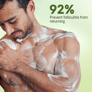 Man applying ABERA Folliculitis Shower Gel to his chest and shoulder with a 92 percent recurring folliculitis prevention claim.